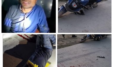 जौनपुर/गोलियां की आवाज से आसपास के लोगो में दहशत ,बदमाश  हुआ घायल