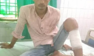 पुलिस मुठभेड़ में एक बदमाश के पैर में लगी गोली 