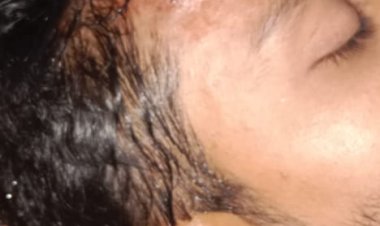 बर्थडे मना रहे दिव्यांशु साहू पर  अमित गुप्ता ने किया जानलेवा हमला