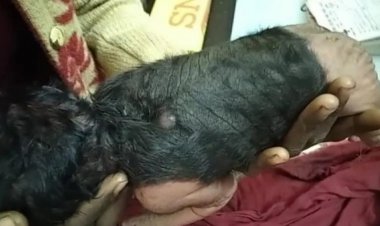 महिला ने दिया विचित्र बच्चे को जन्म,नर्स की निकल गई चीख