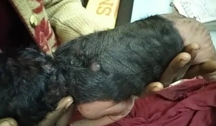 महिला ने दिया विचित्र बच्चे को जन्म,नर्स की निकल गई चीख